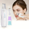Peeling Ultrassônico Facial – Limpador de Cravos e Rejuvenescedor Portátil