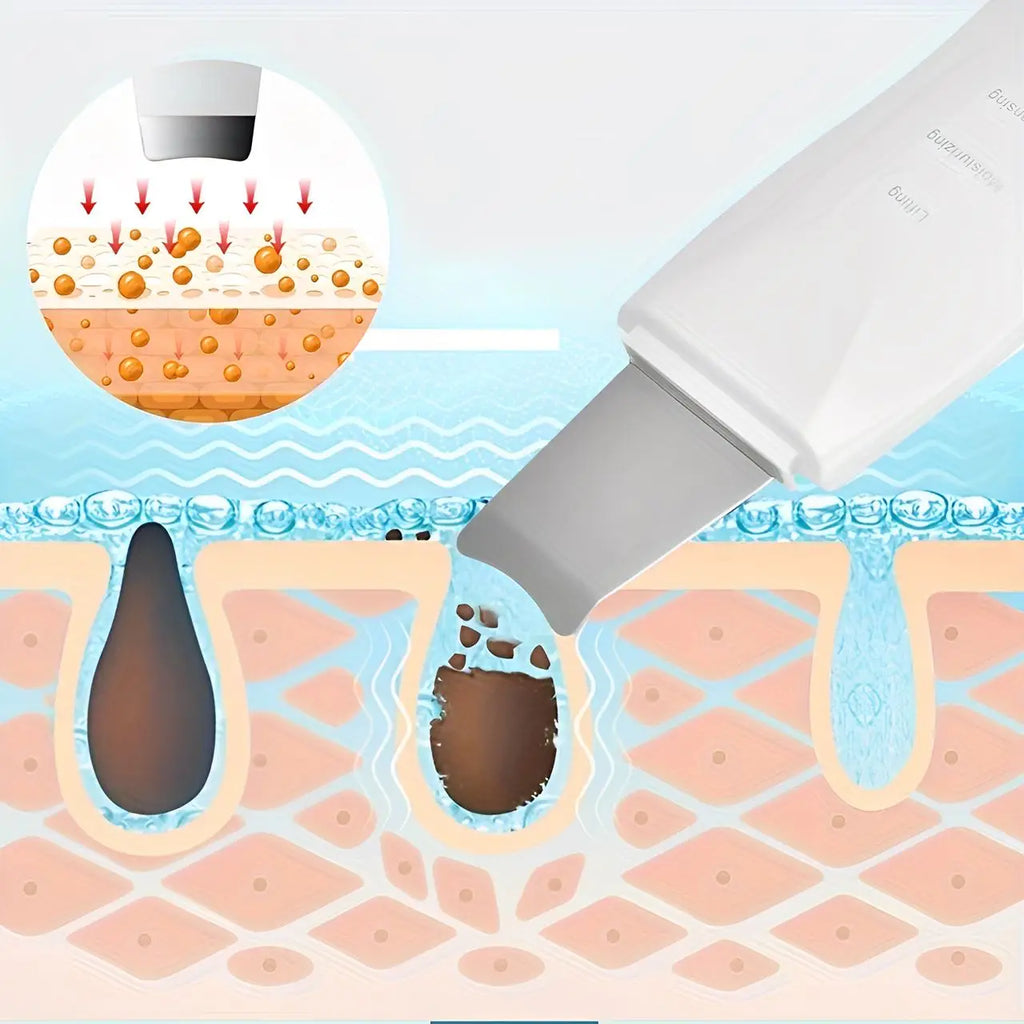 Peeling Ultrassônico Facial – Limpador de Cravos e Rejuvenescedor Portátil