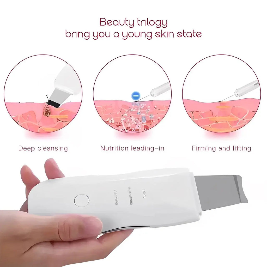 Peeling Ultrassônico Facial – Limpador de Cravos e Rejuvenescedor Portátil