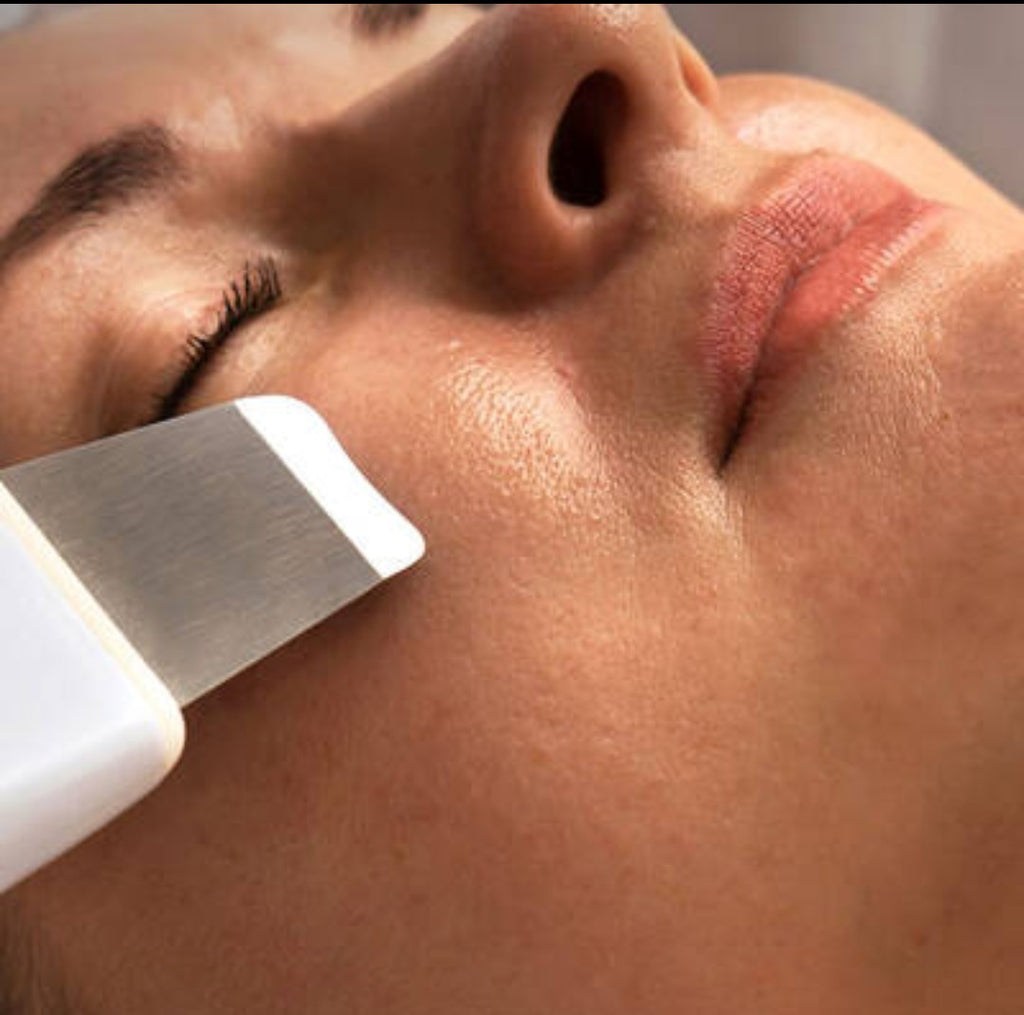 Peeling Ultrassônico Facial – Limpador de Cravos e Rejuvenescedor Portátil