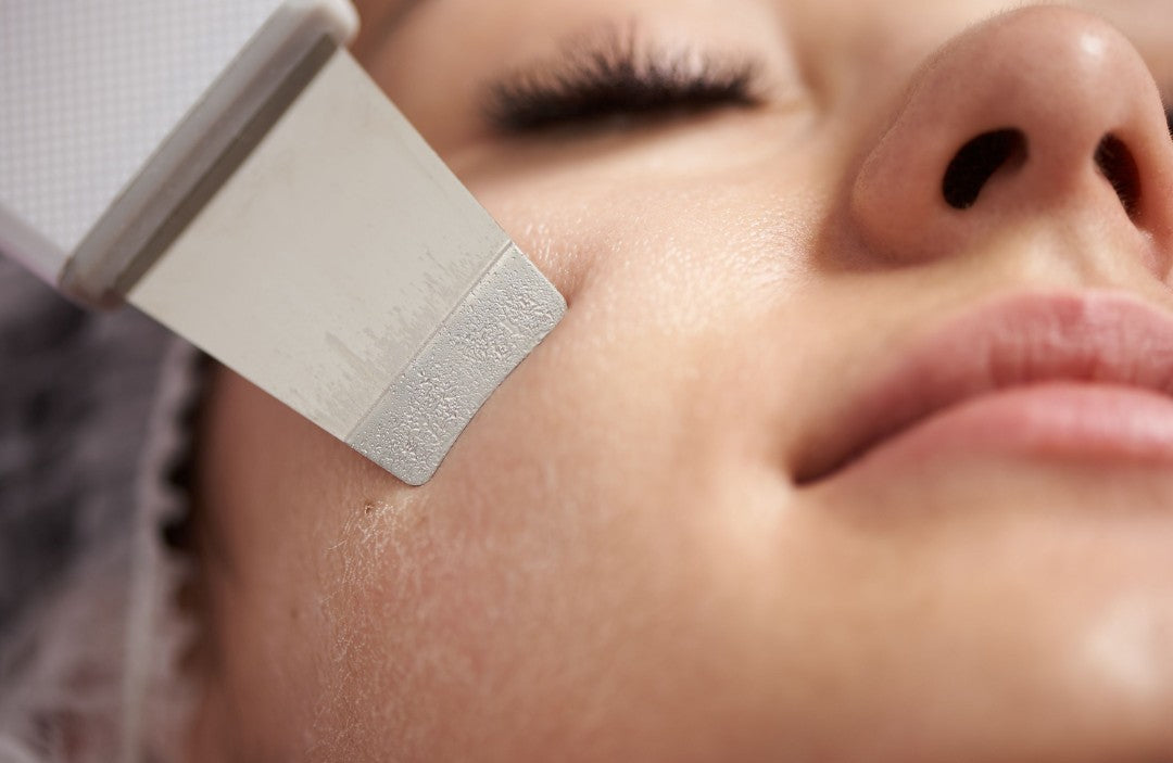 Peeling Ultrassônico Facial – Limpador de Cravos e Rejuvenescedor Portátil